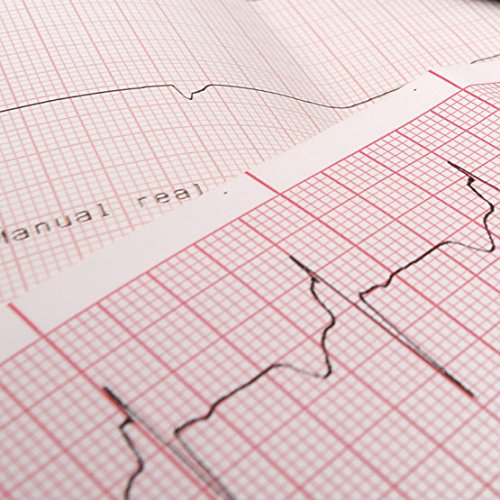 Carta compatibile elettrocardiografi Cardioline